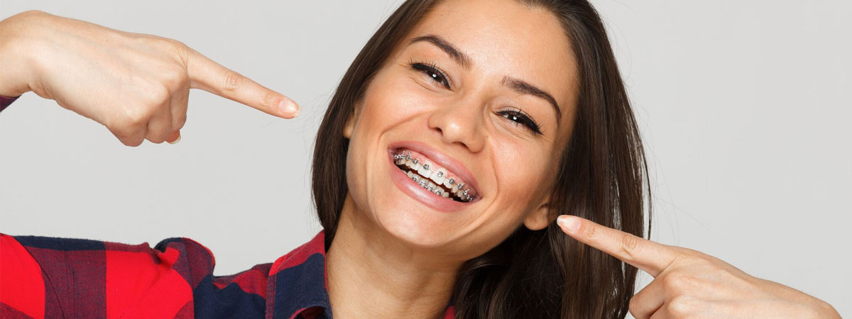 Traditional Metal Braces
