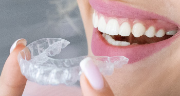 Clear Aligners Spark and Invisalign Carol Stream, Glendale Heights, Bloomingdale, Keeneyville All About Yue Orthodontist