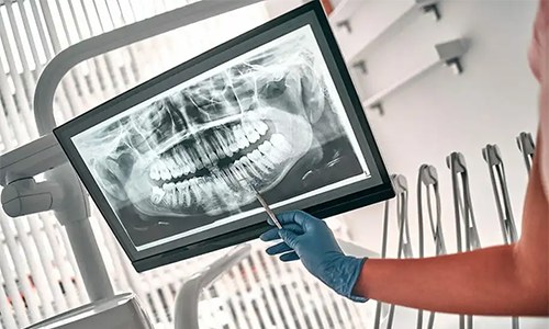 Surgical Orthodontics All About Yue