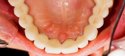 All About Yue Orthodontics All About Yue Orthodontics
