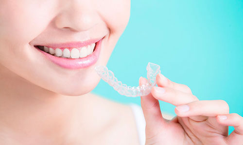 Invisalign Spark Carol Stream, Glendale Heights, Bloomingdale, Keeneyville All About Yue Orthodontics 